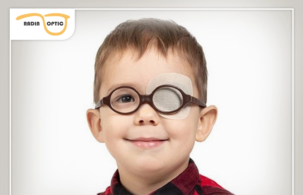 تنبلی چشم در کودکان (آمبلیوپی) چیست؟