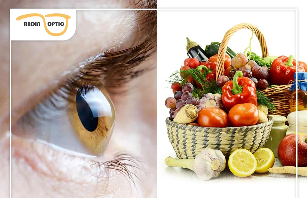 تغذیه مناسب برای قوز قرنیه و جلوگیری از پیشرفت آن