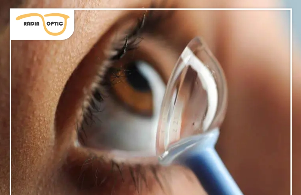 لنز اسکلرال | راحتی، دید بهتر و مراقبت از چشم