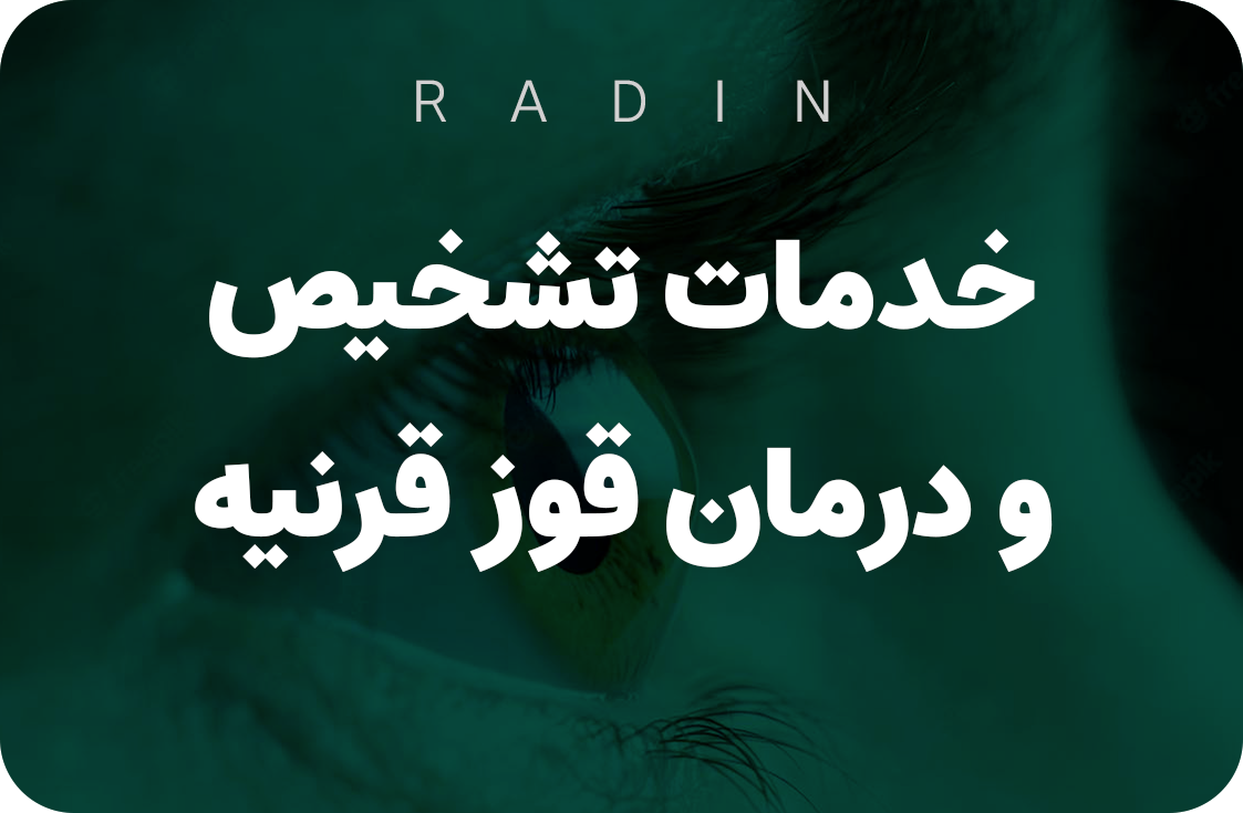 درمان قوز قرنیه در یزد | کلینیک تخصصی اپتومتری رادین